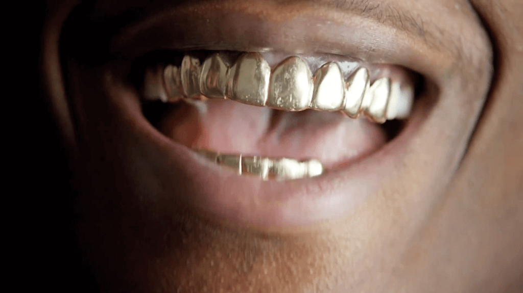 Вставить золотой зуб